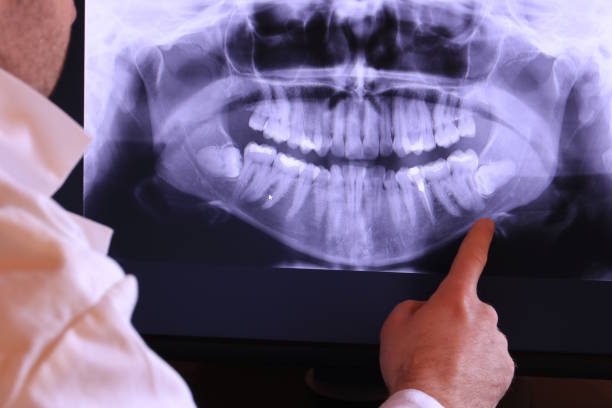 Best Walk-In Emergency Dentist in Springdale, MD
