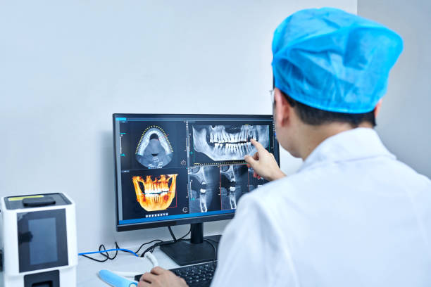Best Emergency Tooth Extraction in Springdale, MD